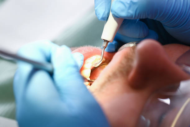 Best Emergency Treatment for Toothache in Long Beach, MS